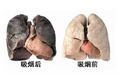 吸烟前后对比图
